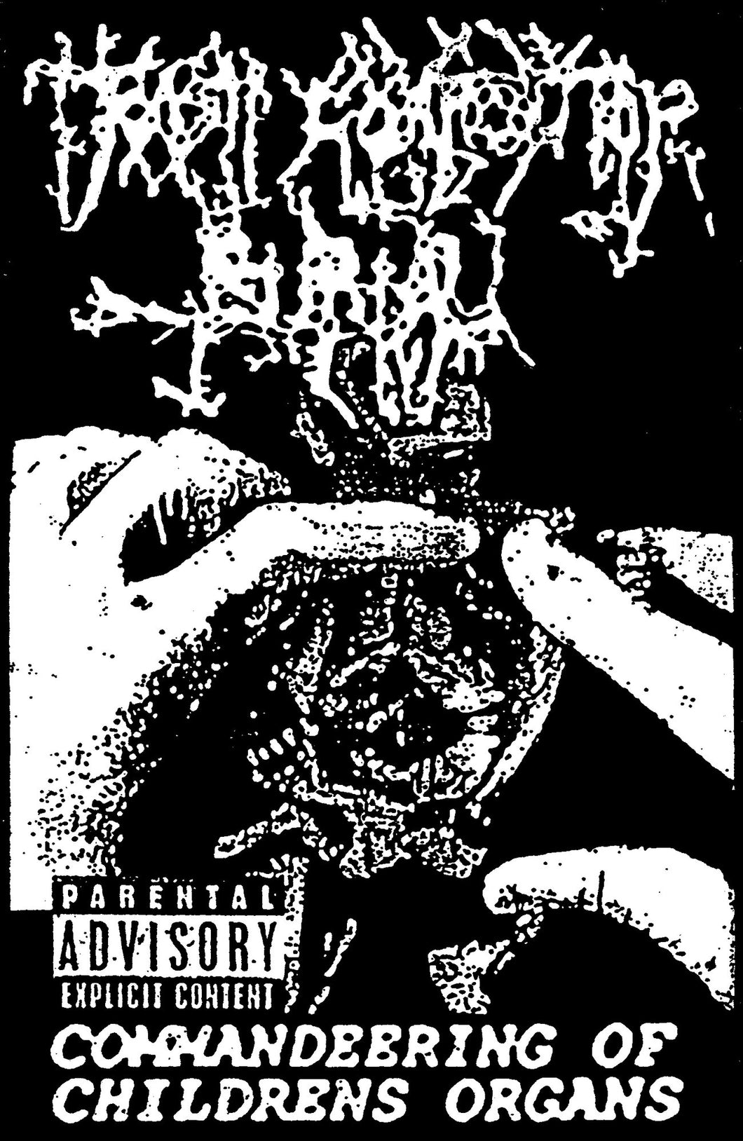 Trash Compactor Burial - Commandeering Of Children’s Organs CS (Reanimated Miscarriage)